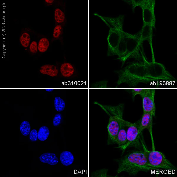 Immunocytochemistry/ Immunofluorescence - Alexa Fluor® 647 Anti-SOX10 antibody [EPR4007] (AB310021)