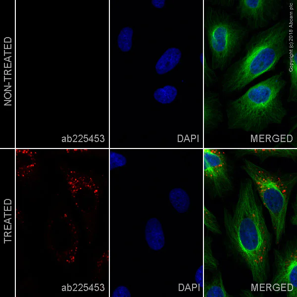 Immunocytochemistry/ Immunofluorescence - Alexa Fluor® 647 Anti-SQSTM1 / p62 antibody [EPR18351] - Autophagosome Marker (AB225453)