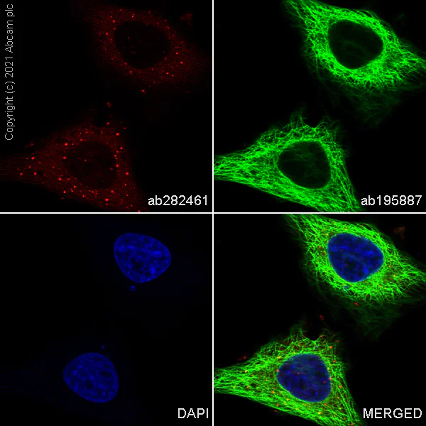Immunocytochemistry/ Immunofluorescence - Alexa Fluor® 647 Anti-SQSTM1 / p62 antibody [EPR23101-103] - Autophagosome Marker (AB282461)