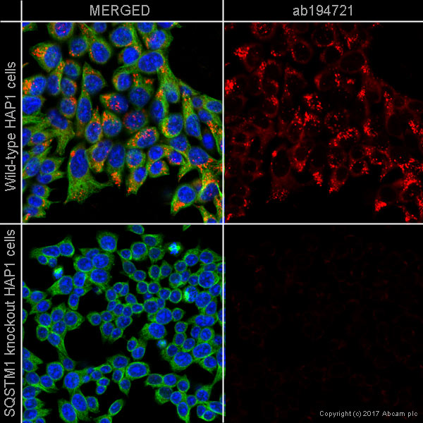 Immunocytochemistry/ Immunofluorescence - Alexa Fluor® 647 Anti-SQSTM1 / p62 antibody [EPR4844] - Autophagosome Marker (AB194721), expandable thumbnail