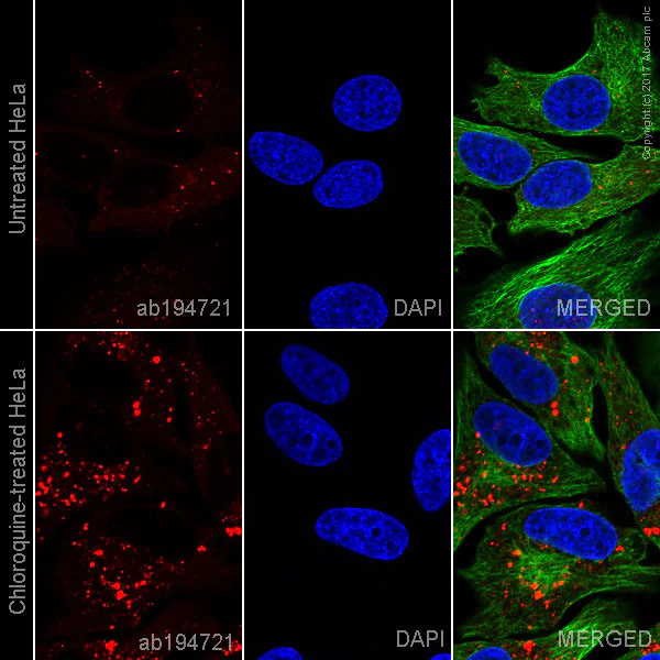 Immunocytochemistry/ Immunofluorescence - Alexa Fluor® 647 Anti-SQSTM1 / p62 antibody [EPR4844] - Autophagosome Marker (AB194721)