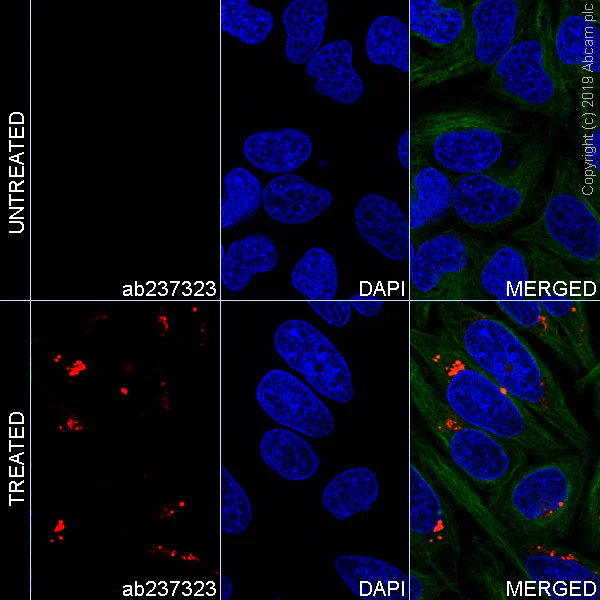 Immunocytochemistry/ Immunofluorescence - Alexa Fluor® 647 Anti-SQSTM1 / p62 (phospho S349) antibody [EPR20451] (AB237323)