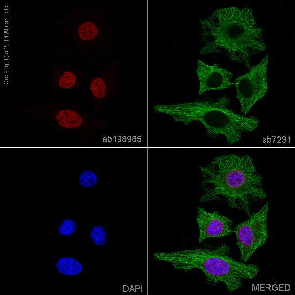 Immunocytochemistry/ Immunofluorescence - Alexa Fluor® 647 Anti-SUN2 antibody [EPR6557] (AB198985)