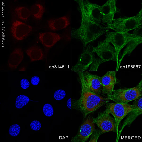 Immunocytochemistry/ Immunofluorescence - Alexa Fluor® 647 Anti-Superoxide Dismutase 1 antibody [EP1727Y] (AB314511)