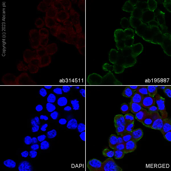 Immunocytochemistry/ Immunofluorescence - Alexa Fluor® 647 Anti-Superoxide Dismutase 1 antibody [EP1727Y] (AB314511)