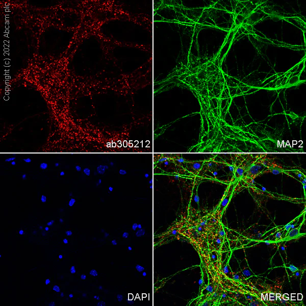 Immunocytochemistry/ Immunofluorescence - Alexa Fluor® 647 Anti-Synapsin I antibody [EPR23531-50] - Synaptic Marker (AB305212)