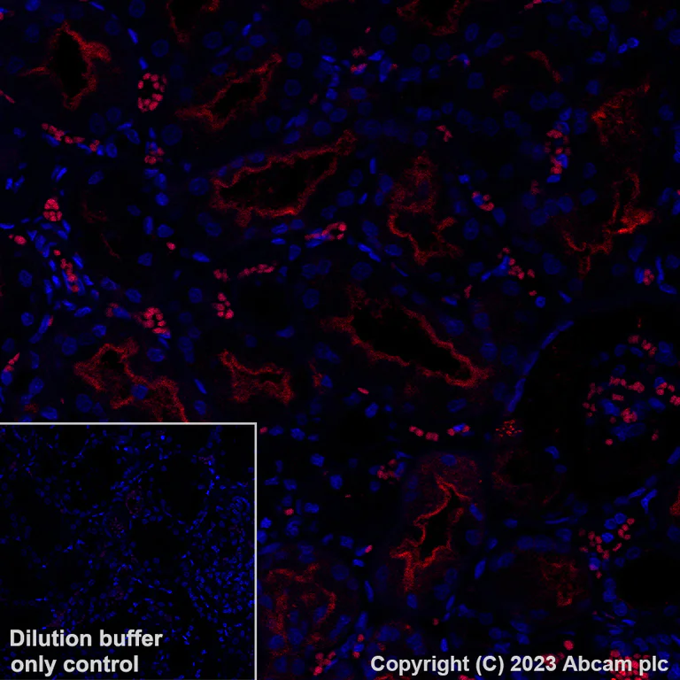 Immunohistochemistry (Formalin/PFA-fixed paraffin-embedded sections) - Alexa Fluor® 647 Anti-Syntaxin 3 antibody [EPR8543] (AB314933)