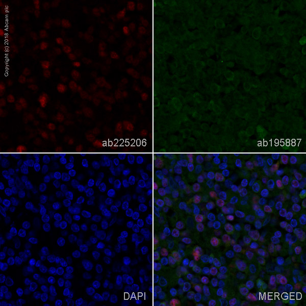 Immunohistochemistry (Formalin/PFA-fixed paraffin-embedded sections) - Alexa Fluor® 647 Anti-T-bet / Tbx21 antibody [EPR9302] (AB225206)