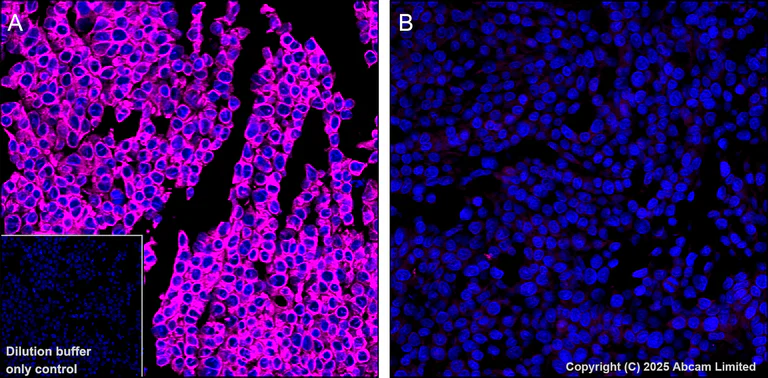 Immunohistochemistry (Formalin/PFA-fixed paraffin-embedded sections) - Alexa Fluor® 647 Anti-TAP1 antibody [EPR26236-92] (AB325698)