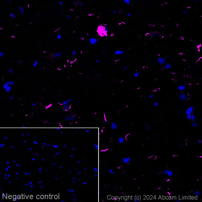 Immunohistochemistry (Frozen sections) - Alexa Fluor® 647 Anti-Tau Alzheimer’s Disease antibody [GT-38] - Conformation-Specific (AB317764)