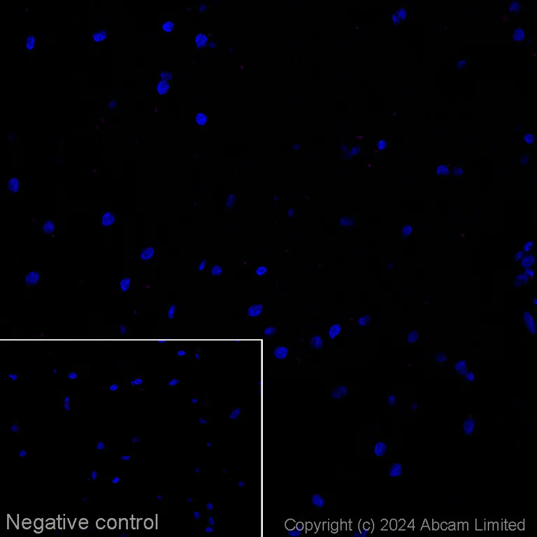 Immunohistochemistry (Frozen sections) - Alexa Fluor® 647 Anti-Tau Alzheimer’s Disease antibody [GT-38] - Conformation-Specific (AB317764)