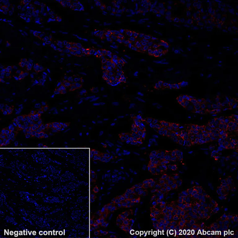 Immunohistochemistry (Formalin/PFA-fixed paraffin-embedded sections) - Alexa Fluor® 647 Anti-Tau antibody [SP70] (AB279688)
