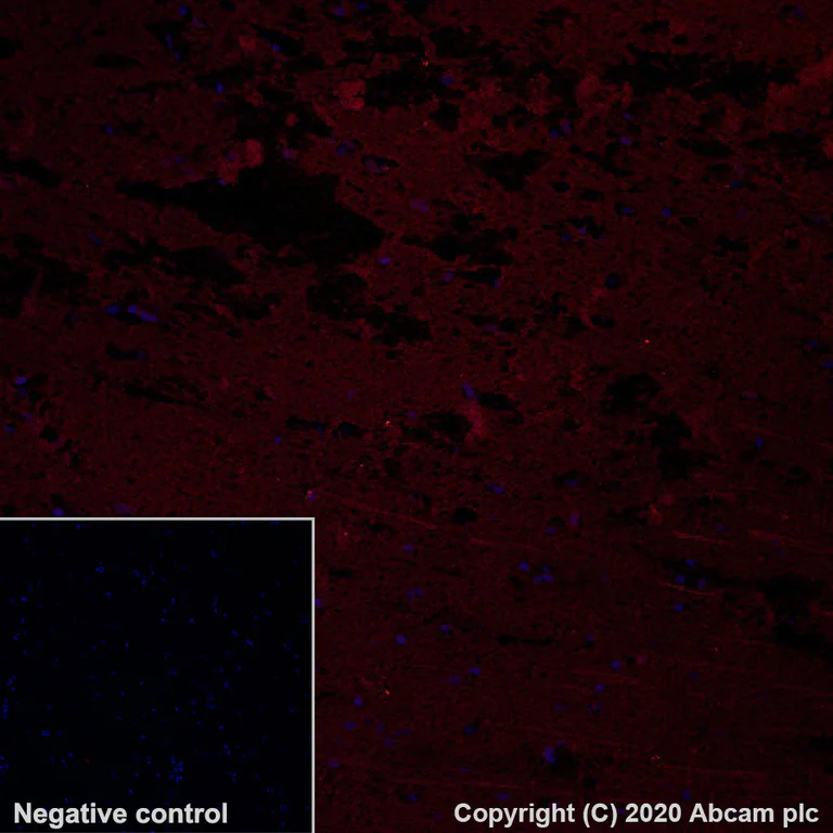 Immunohistochemistry (Formalin/PFA-fixed paraffin-embedded sections) - Alexa Fluor® 647 Anti-Tau antibody [SP70] (AB279688)