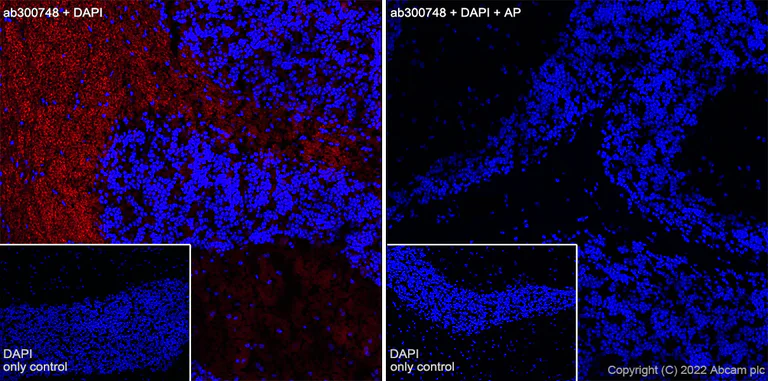 Immunohistochemistry (Frozen sections) - Alexa Fluor® 647 Anti-Tau (phospho S396) antibody [EPR2731] (AB300748)