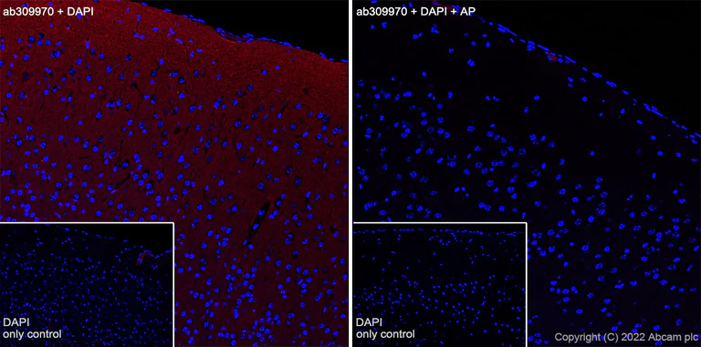Immunohistochemistry (Frozen sections) - Alexa Fluor® 647 Anti-Tau (phospho T181) antibody [EPR23506-107] (AB309970)