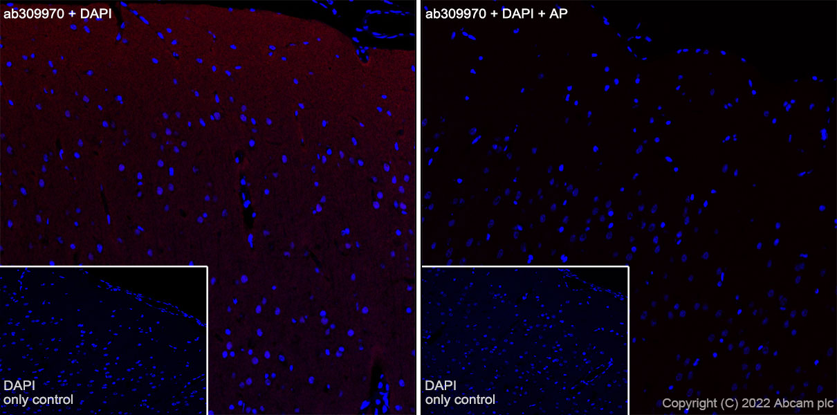 Immunohistochemistry (Frozen sections) - Alexa Fluor® 647 Anti-Tau (phospho T181) antibody [EPR23506-107] (AB309970), expandable thumbnail