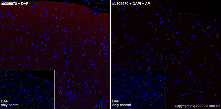 Immunohistochemistry (Frozen sections) - Alexa Fluor® 647 Anti-Tau (phospho T181) antibody [EPR23506-107] (AB309970)