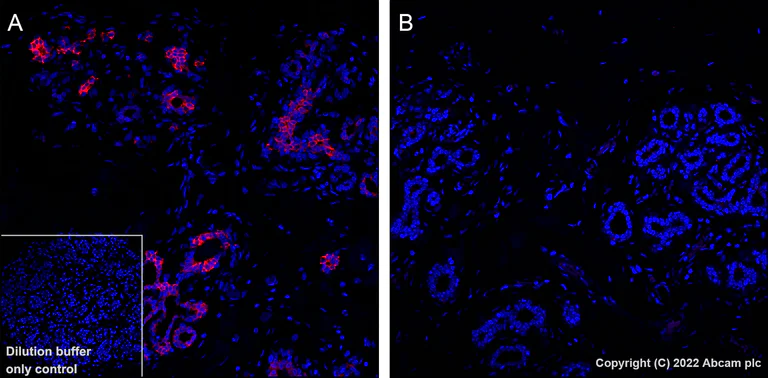 Immunohistochemistry (Formalin/PFA-fixed paraffin-embedded sections) - Alexa Fluor® 647 Anti-Tau (phospho T205) antibody [EPR23505-13] (AB307376)