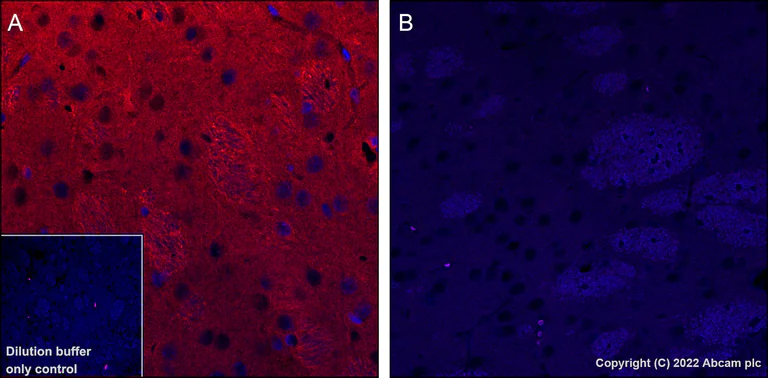 Immunohistochemistry (Formalin/PFA-fixed paraffin-embedded sections) - Alexa Fluor® 647 Anti-Tau (phospho T205) antibody [EPR23505-13] (AB307376)
