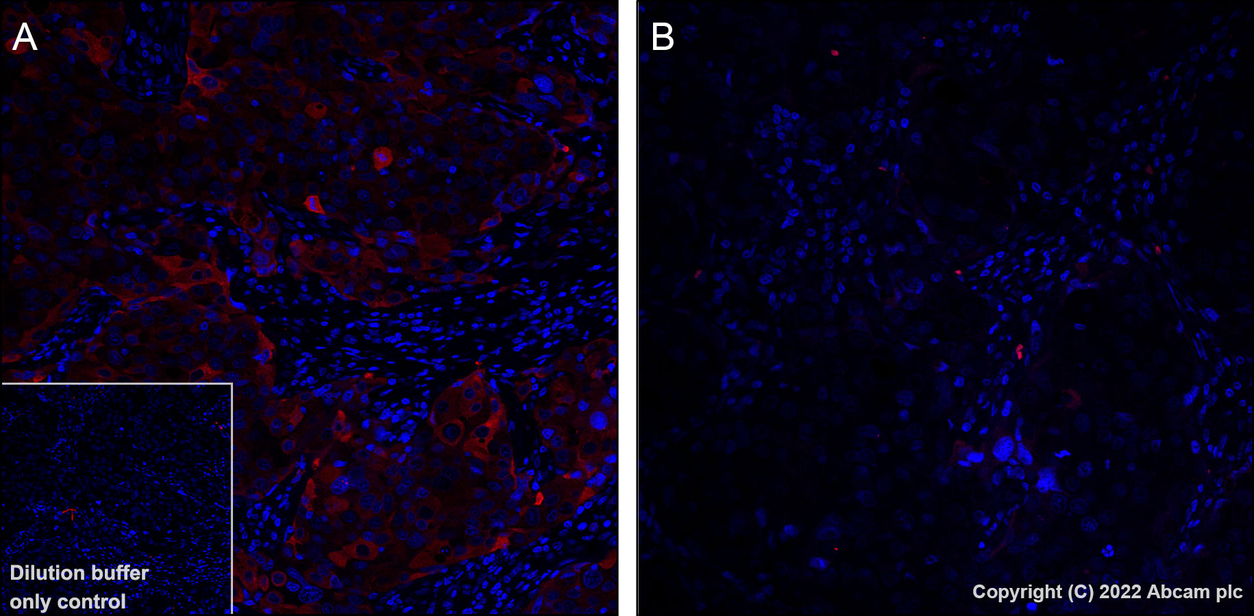 Immunohistochemistry (Formalin/PFA-fixed paraffin-embedded sections) - Alexa Fluor® 647 Anti-Tau (phospho T205) antibody [EPR23505-13] (AB307376)