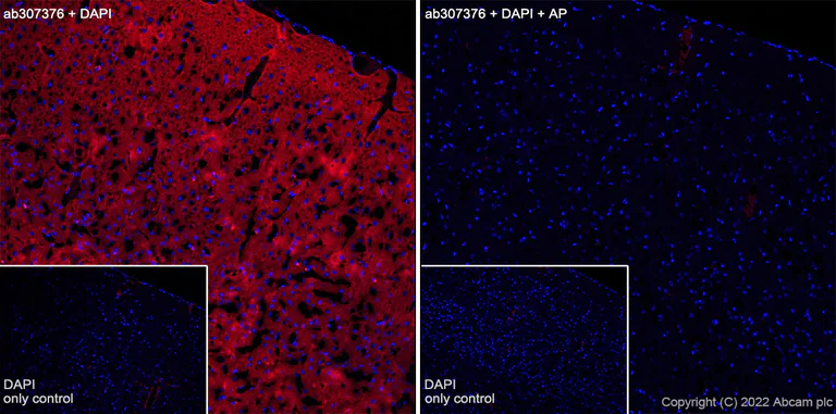 Immunohistochemistry (Frozen sections) - Alexa Fluor® 647 Anti-Tau (phospho T205) antibody [EPR23505-13] (AB307376)