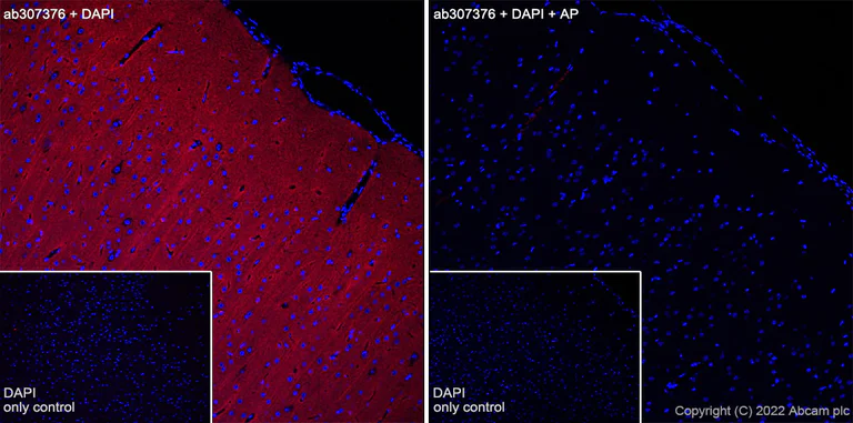 Immunohistochemistry (Frozen sections) - Alexa Fluor® 647 Anti-Tau (phospho T205) antibody [EPR23505-13] (AB307376)