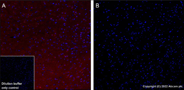 Immunohistochemistry (Formalin/PFA-fixed paraffin-embedded sections) - Alexa Fluor® 647 Anti-Tau (phospho T231) antibody [EPR2488] (AB303468)