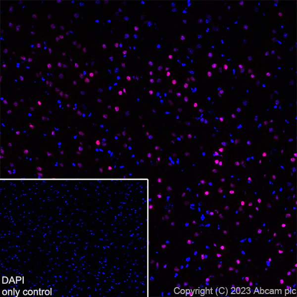 Immunohistochemistry (Frozen sections) - Alexa Fluor® 647 Anti-TBR1 antibody [EPR8138(2)] (AB314473)