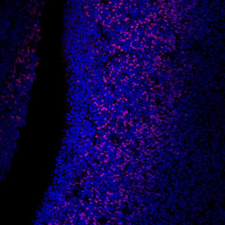 Immunohistochemistry (Formalin/PFA-fixed paraffin-embedded sections) - Alexa Fluor® 647 Anti-TBR2 / Eomes antibody [EPR19012] (AB315356)