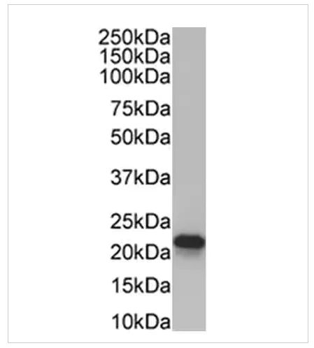 Western blot - Alexa Fluor® 647 Anti-TBR2 / Eomes antibody [EPR19012] (AB315356)