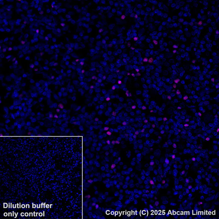 Immunohistochemistry (Formalin/PFA-fixed paraffin-embedded sections) - Alexa Fluor® 647 Anti-TCF7 antibody [EPR28579-5] (AB323657)
