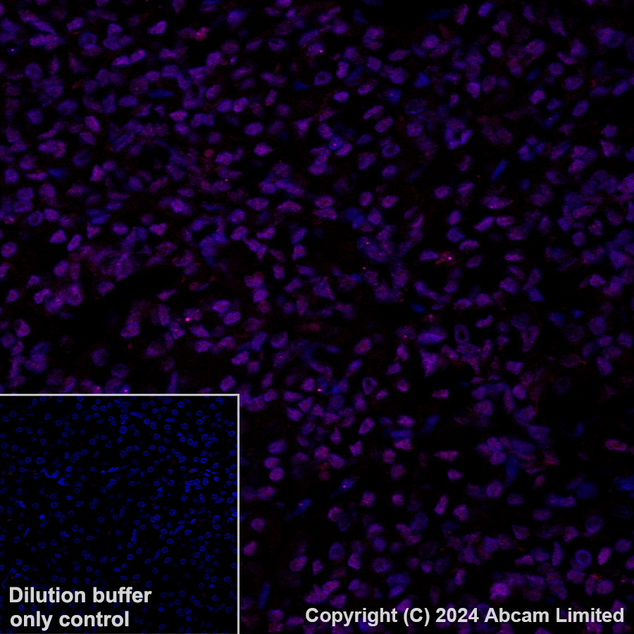 Immunohistochemistry (Formalin/PFA-fixed paraffin-embedded sections) - Alexa Fluor® 647 Anti-TEAD4 antibody [EPR26046-193] (AB323463), expandable thumbnail