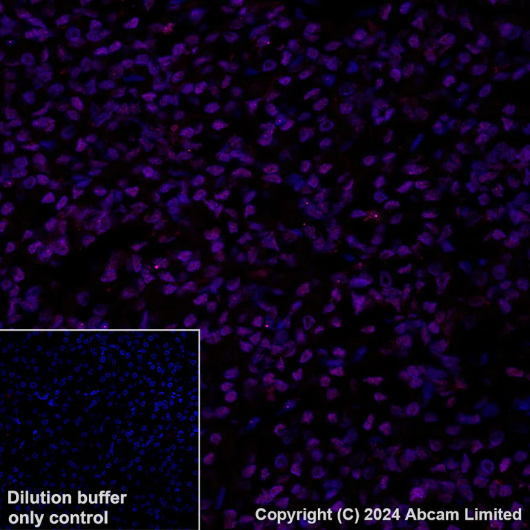 Immunohistochemistry (Formalin/PFA-fixed paraffin-embedded sections) - Alexa Fluor® 647 Anti-TEAD4 antibody [EPR26046-193] (AB323463)