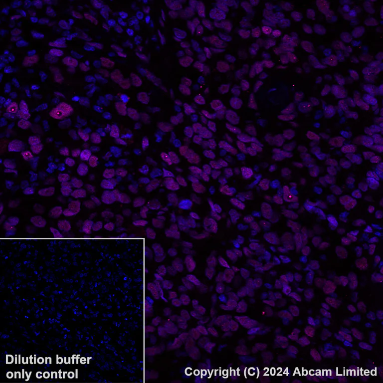 Immunohistochemistry (Formalin/PFA-fixed paraffin-embedded sections) - Alexa Fluor® 647 Anti-TEAD4 antibody [EPR26046-193] (AB323463)