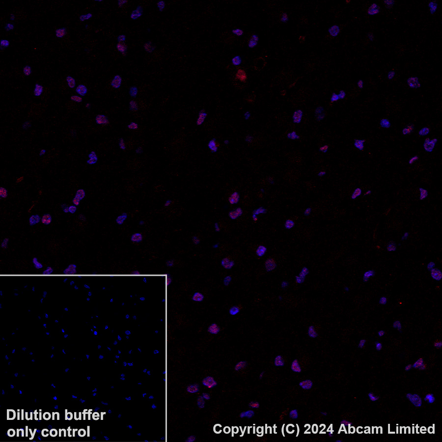Immunohistochemistry (Formalin/PFA-fixed paraffin-embedded sections) - Alexa Fluor® 647 Anti-TEAD4 antibody [EPR26046-193] (AB323463), expandable thumbnail