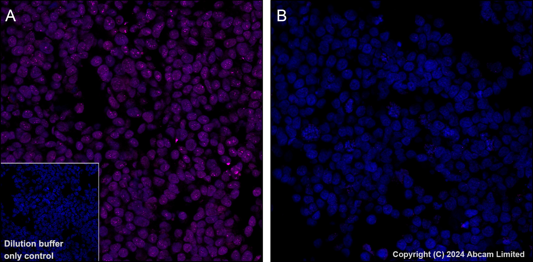 Immunohistochemistry (Formalin/PFA-fixed paraffin-embedded sections) - Alexa Fluor® 647 Anti-TEAD4 antibody [EPR26046-193] (AB323463), expandable thumbnail
