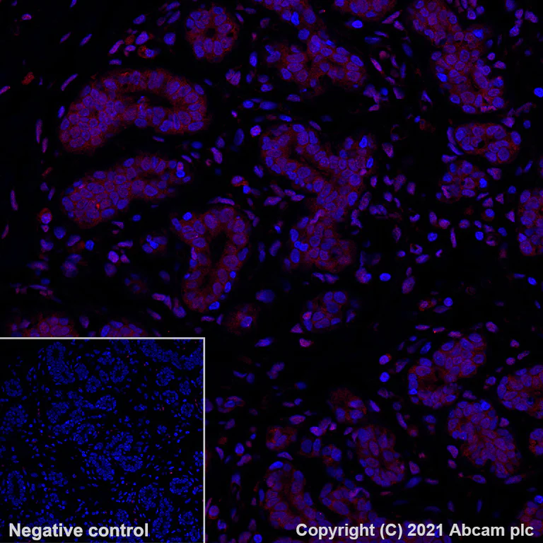 Immunohistochemistry (Formalin/PFA-fixed paraffin-embedded sections) - Alexa Fluor® 647 Anti-TFEB antibody [EPR22940-151] (AB283274)