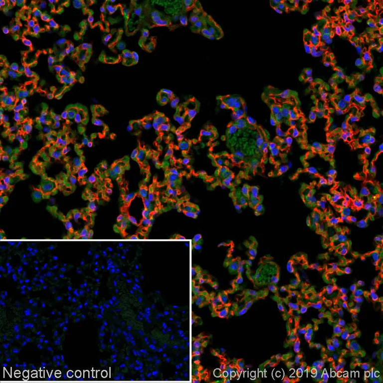Immunohistochemistry (Formalin/PFA-fixed paraffin-embedded sections) - Alexa Fluor® 647 Anti-Thrombomodulin antibody [EPR18217] (AB252146)