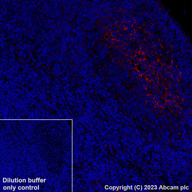 Immunohistochemistry (Formalin/PFA-fixed paraffin-embedded sections) - Alexa Fluor® 647 Anti-TIGIT antibody [EPR26037-152] (AB308430)