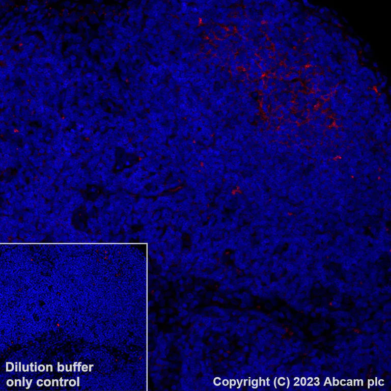 Immunohistochemistry (Formalin/PFA-fixed paraffin-embedded sections) - Alexa Fluor® 647 Anti-TIGIT antibody [EPR26037-152] (AB308430)