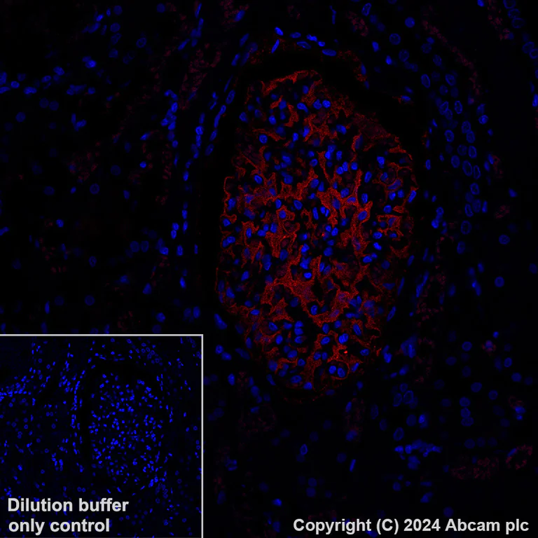 Immunohistochemistry (Formalin/PFA-fixed paraffin-embedded sections) - Alexa Fluor® 647 Anti-Tissue Factor antibody [EPR22548-232] (AB318167)