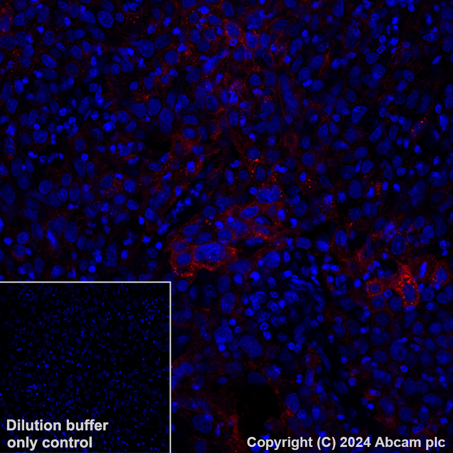 Immunohistochemistry (Formalin/PFA-fixed paraffin-embedded sections) - Alexa Fluor® 647 Anti-Tissue Factor antibody [EPR22548-232] (AB318167), expandable thumbnail