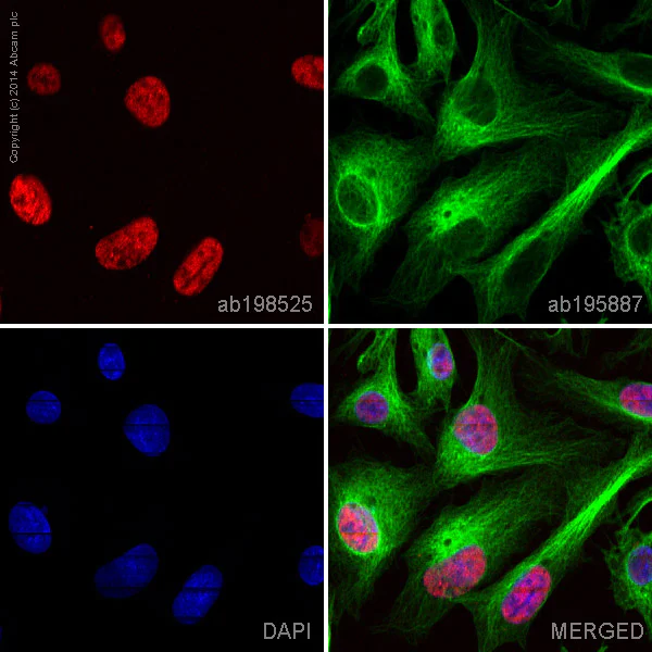 Immunocytochemistry/ Immunofluorescence - Alexa Fluor® 647 Anti-TLE 1 antibody [EPR9386(2)] (AB198525)