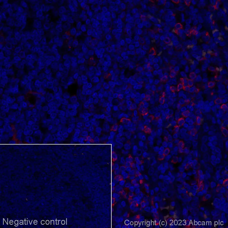 Immunohistochemistry (Formalin/PFA-fixed paraffin-embedded sections) - Alexa Fluor® 647 Anti-TLR7 antibody [EPR2088(2)] (AB314945)