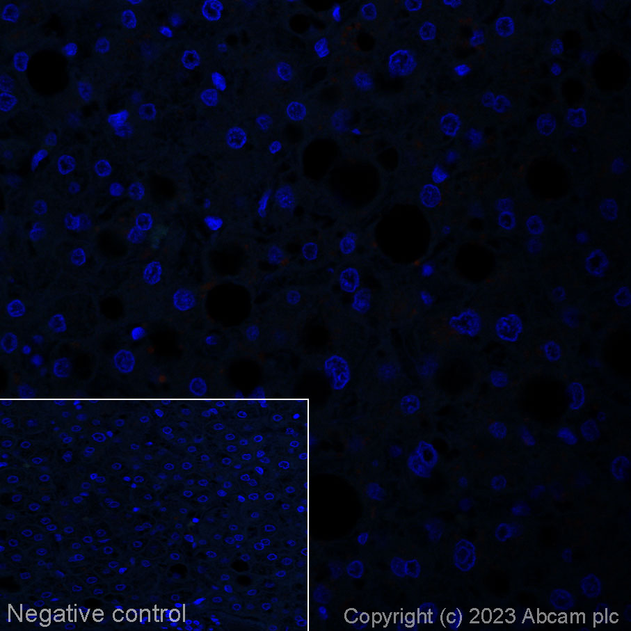 Immunohistochemistry (Formalin/PFA-fixed paraffin-embedded sections) - Alexa Fluor® 647 Anti-TLR7 antibody [EPR2088(2)] (AB314945)