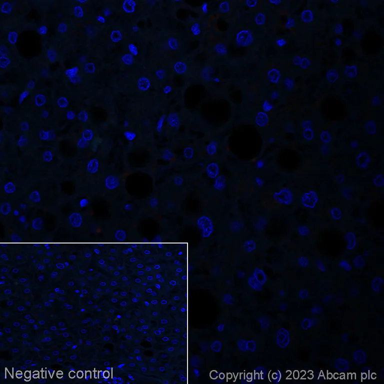 Immunohistochemistry (Formalin/PFA-fixed paraffin-embedded sections) - Alexa Fluor® 647 Anti-TLR7 antibody [EPR2088(2)] (AB314945)