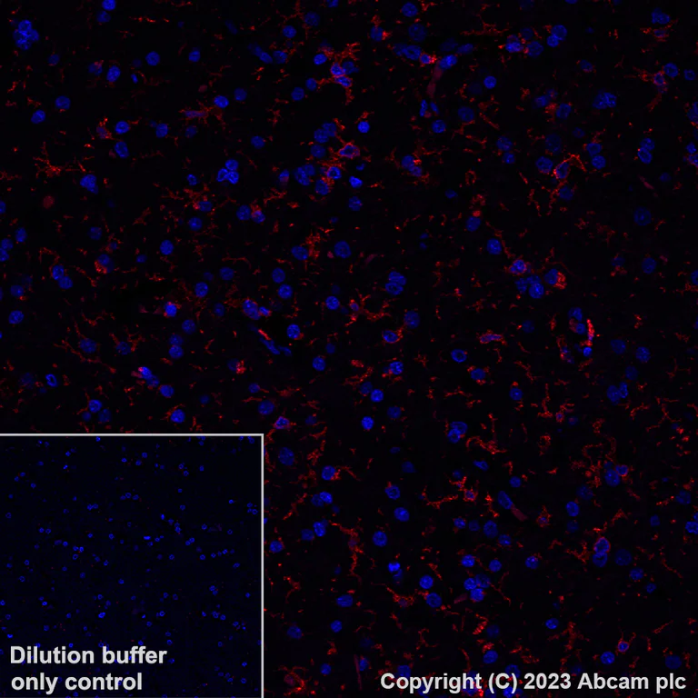 Immunohistochemistry (Formalin/PFA-fixed paraffin-embedded sections) - Alexa Fluor® 647 Anti-TMEM119 antibody [EPR25865-89] - Microglial marker (AB313674)