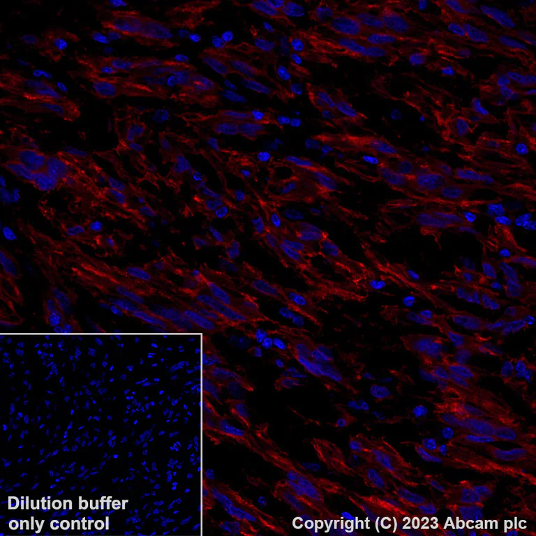Immunohistochemistry (Formalin/PFA-fixed paraffin-embedded sections) - Alexa Fluor® 647 Anti-TMEM16A antibody [SP31] (AB267509)