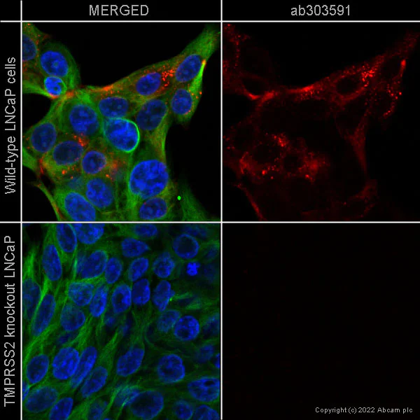 Immunocytochemistry/ Immunofluorescence - Alexa Fluor® 647 Anti-TMPRSS2 antibody [EPR24407-87] (AB303591)