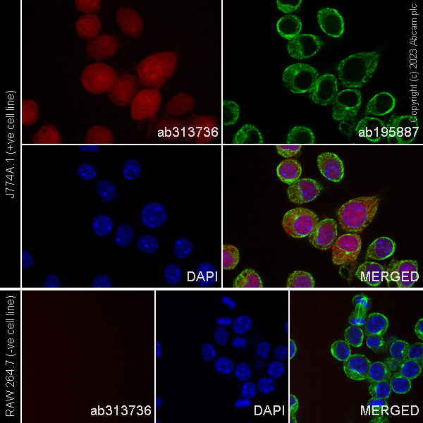 aikuma　ARSOA ソナデイス &cell 6点 Alexa Fluor® 647 Anti-TMS1/ASC antibody [EPR28201-61] (ab313736
